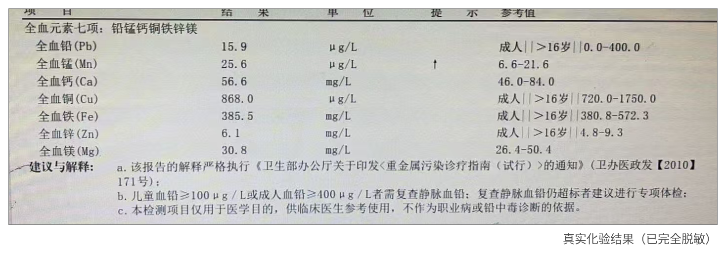 图1 真实化验结果(已完全脱敏)。图中全血铅为15.9 μg/L,即1.59 μg/dL;未达到报告所列成人铅中毒相关复查标准。全血锰25.6 μg/L,轻度高于该实验室参考范围。该报告未检测汞、镉和砷。
