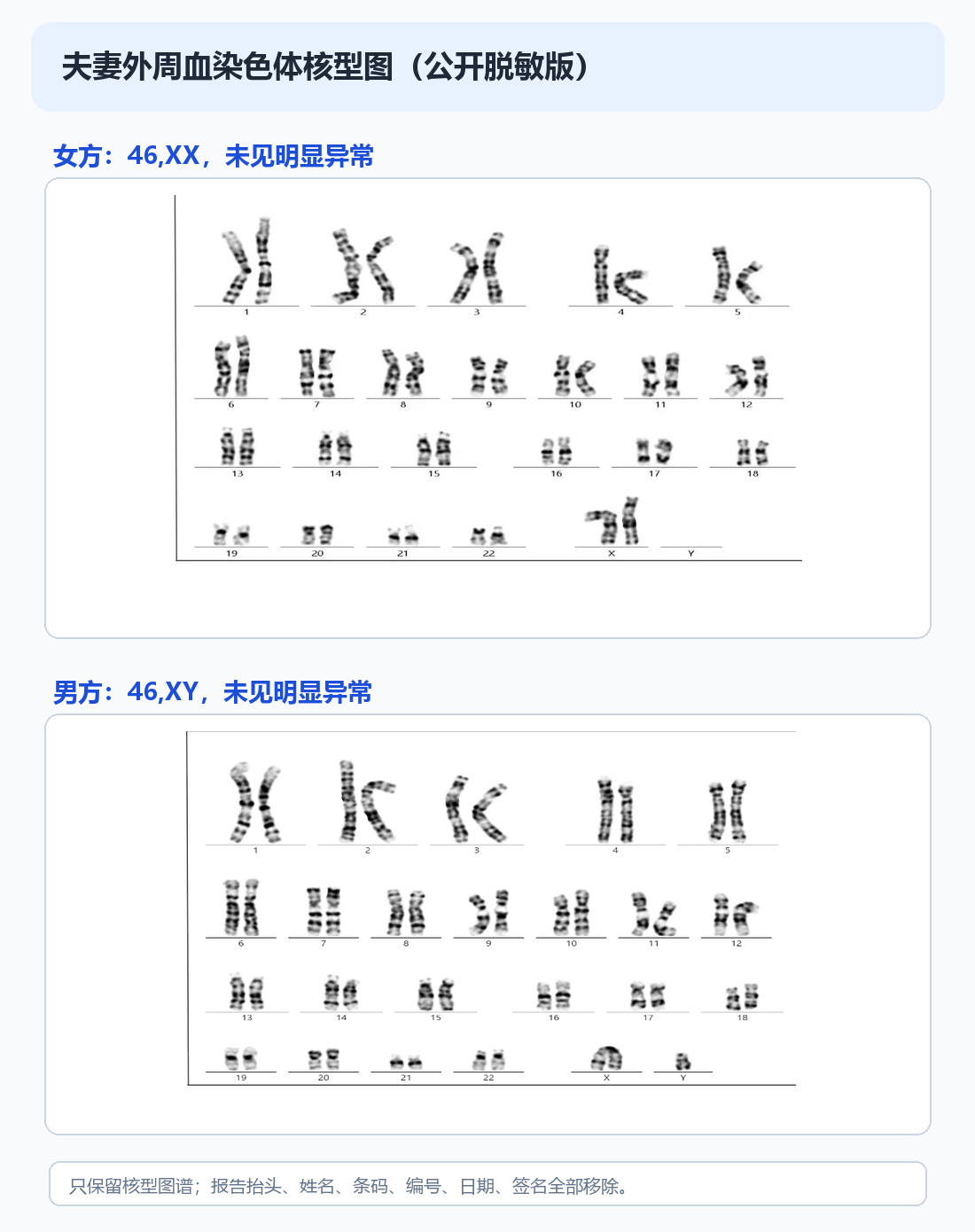 夫妻外周血染色体核型公开脱敏图，女方46,XX，男方46,XY，均未见明显异常