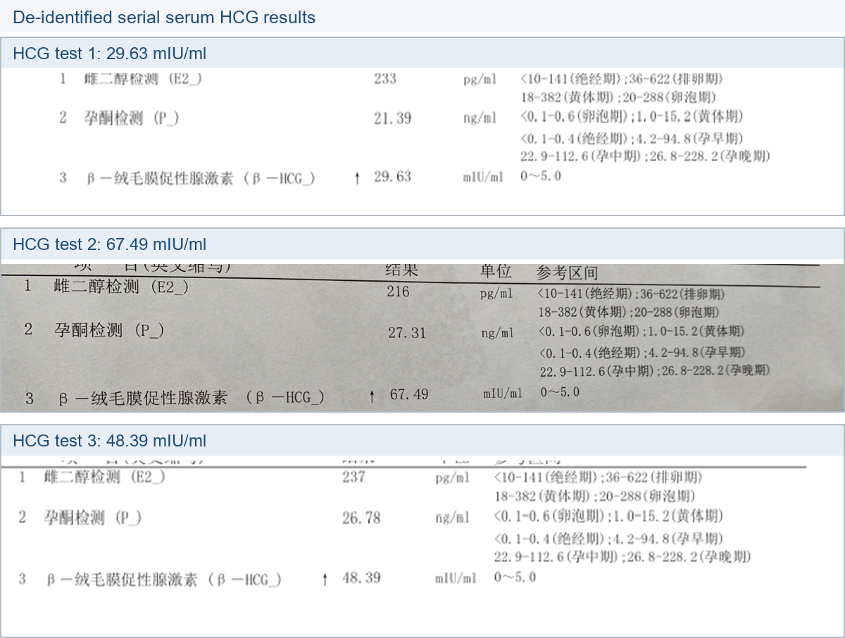 移植后三次血清HCG结果脱敏截取，β-HCG约29.63到67.49再到48.39mIU/ml